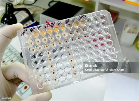 Treponema Pallidum Haemagglutination Assay (TPHA).